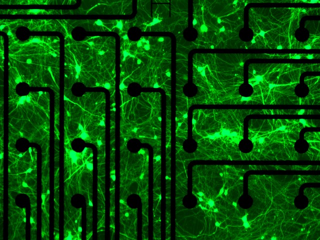 Evangelos Kiskinis’s induced pluripotent stem cell (iPSC) platform